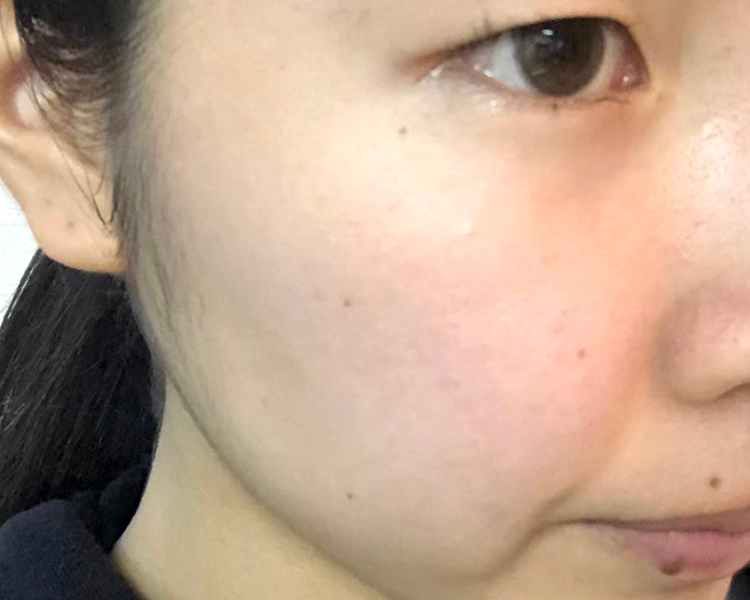 マトリックスエキス　お試し　navis 21日目